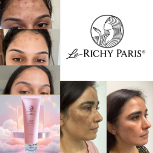 Richy Paris Golden Body Bright Cream for Skin Whitening"